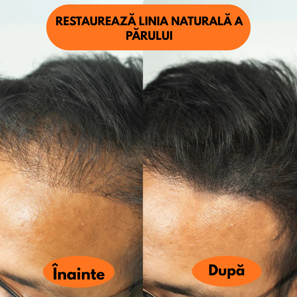 Pudră pentru linia părului, scalp si barbă