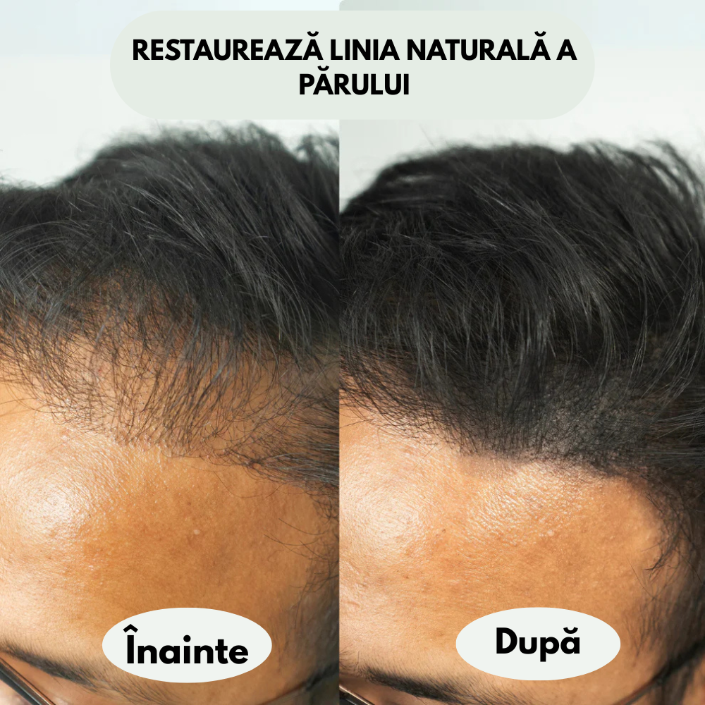 Pudră pentru linia părului, scalp si barbă